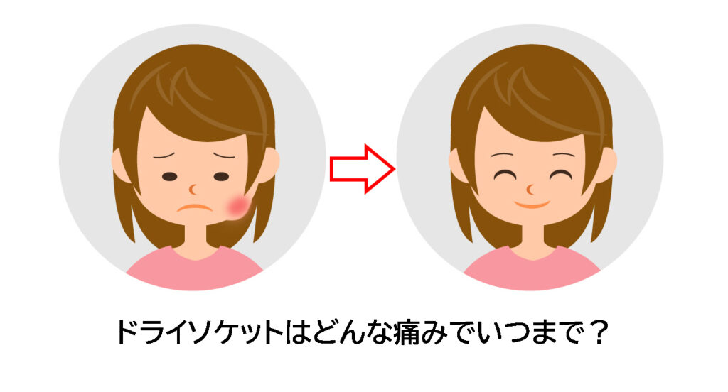 抜歯後のアフターケア