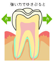 歯に架かる様々な力