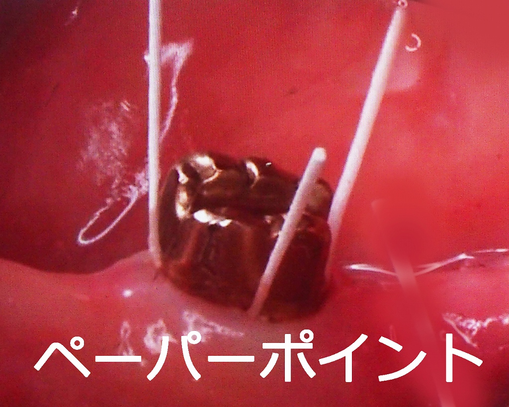 リアルタイムPCR検査