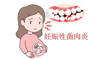 妊婦の歯周病-妊娠性歯肉炎の原因と治し方