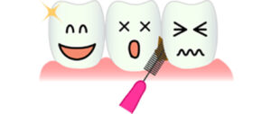 おすすめの歯間ブラシと使い方