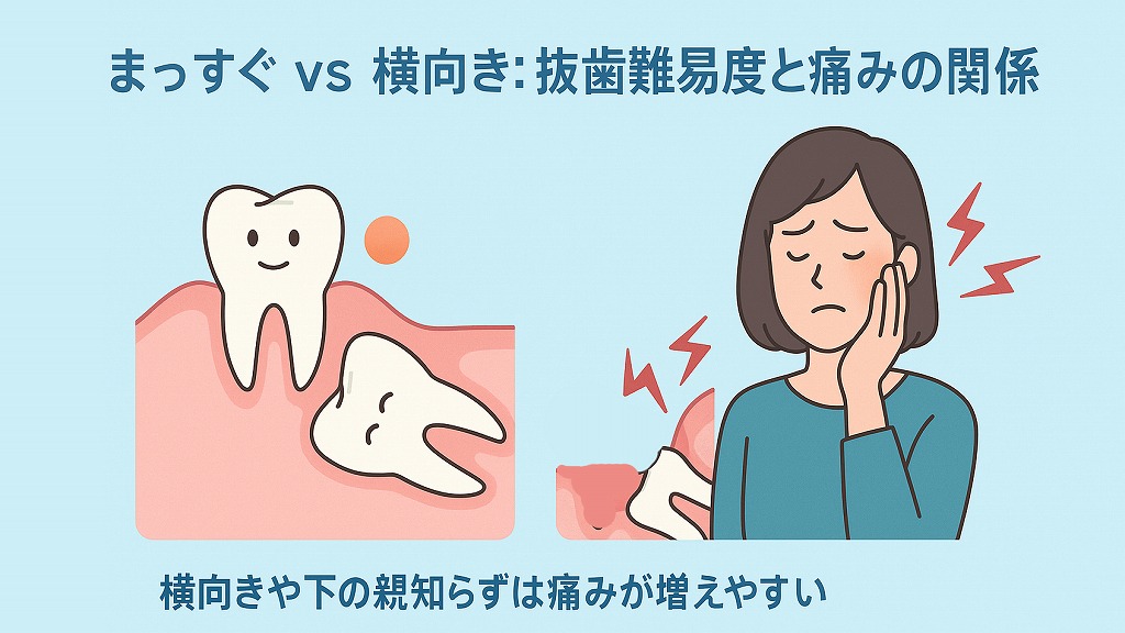抜歯の難易度で痛みの程度と期間は変わる