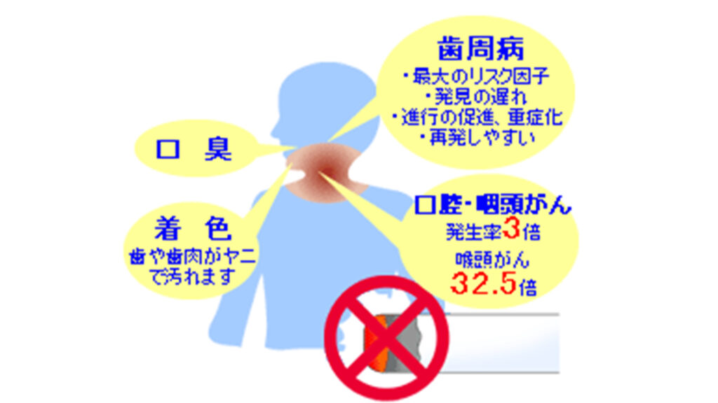 ブリクマン指数が高いとリスクも上昇!