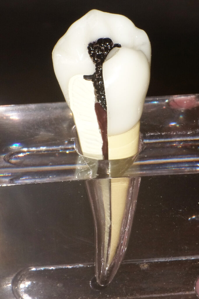 ナノバブル薬剤導入無菌化法