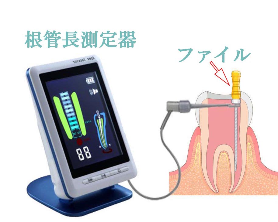 根管長測定