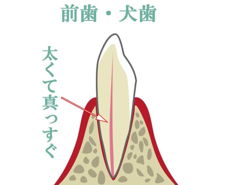 【前歯・犬歯・小臼歯】比較的簡単
