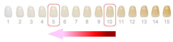 1回の歯の色の変化量