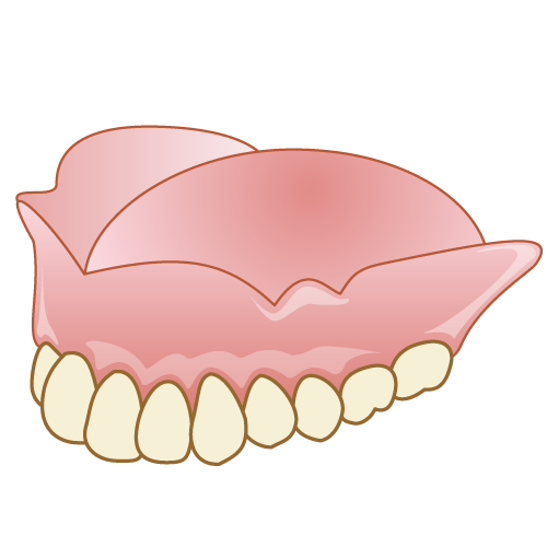 上顎レジン床の総入れ歯