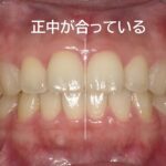 理想的な綺麗な歯並びの条件