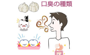 口臭の種類ー生理的口臭と病的口臭