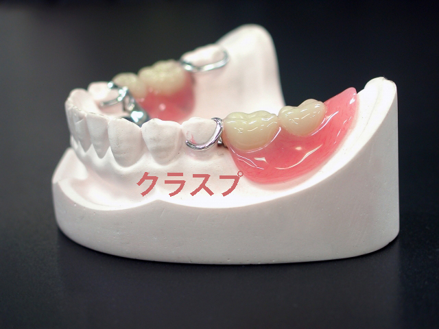 下顎左右奥歯がない保険適用の部分入れ歯