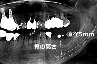 パノラマX線との連携
