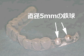 サージカルステント