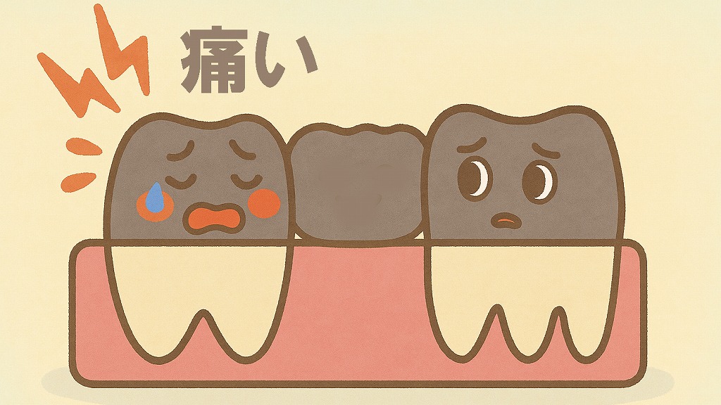 噛み合わせが合っていない・ロングスパンの負担