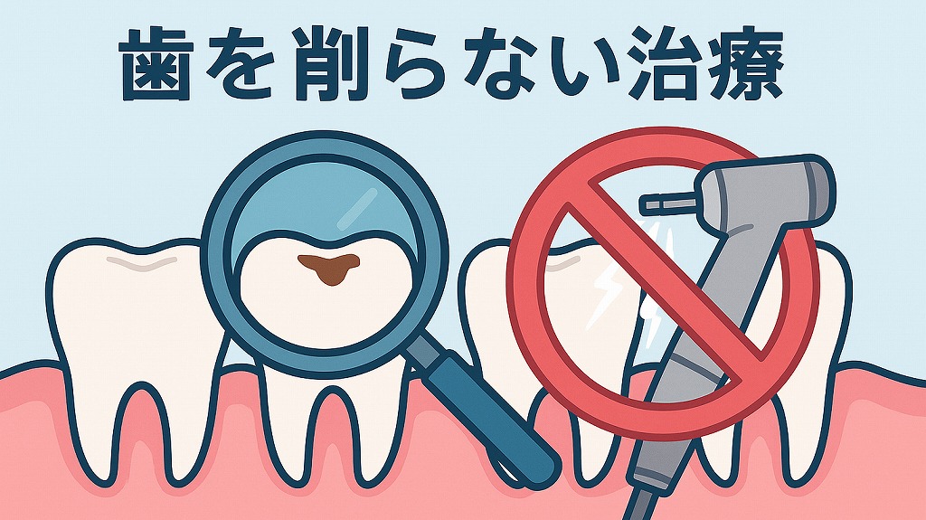 歯を削らない治療