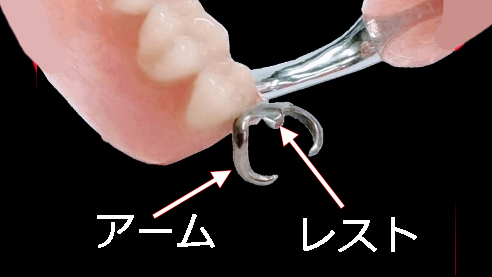 クラスプの基本構造