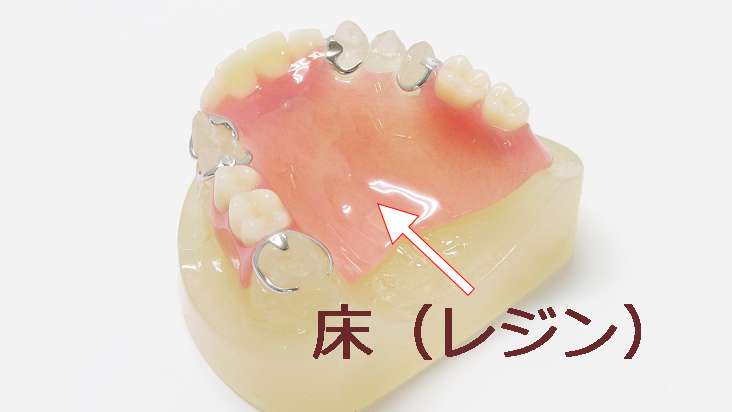 レジン床義歯