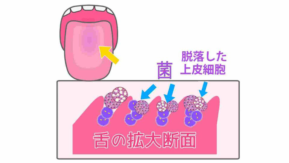 舌苔(ぜったい)とは?
