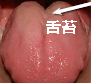 舌苔