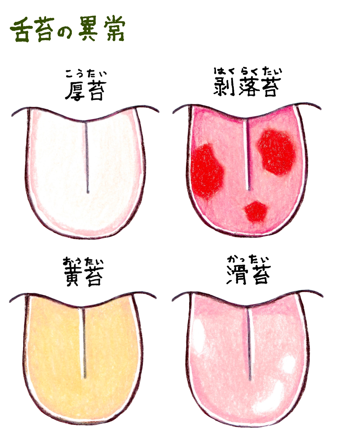 舌苔(ぜったい)とは?原因から除去・予防方法まで徹底解説