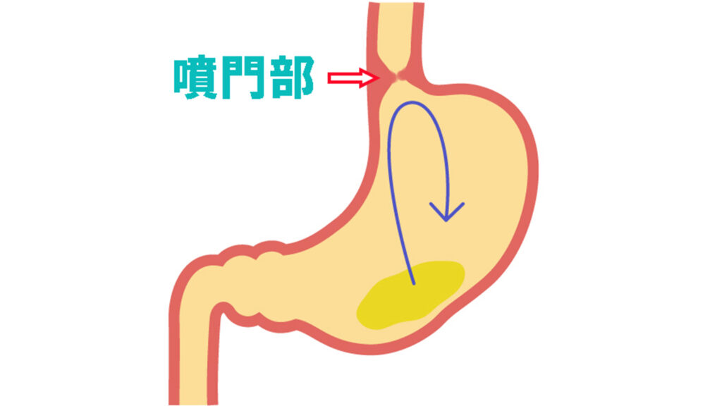 噴門