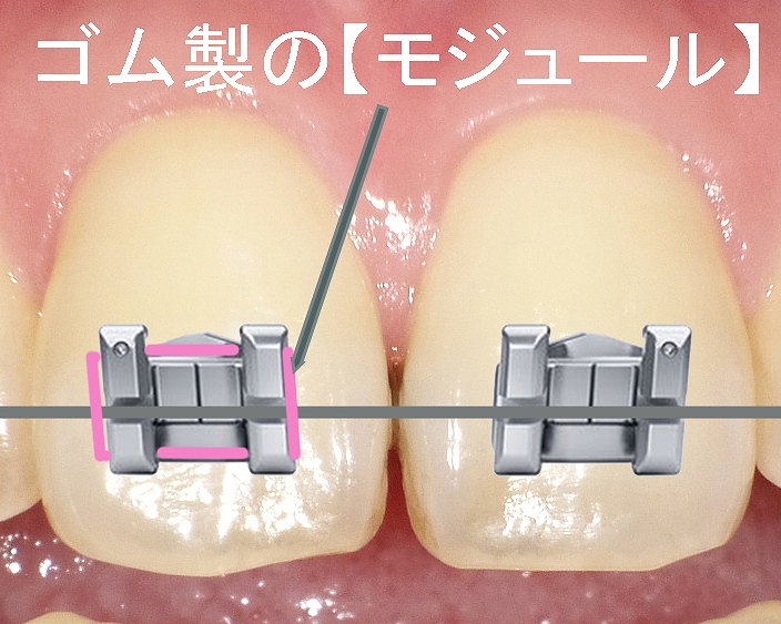 スロットにワイヤーを通す