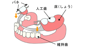 入れ歯の構造