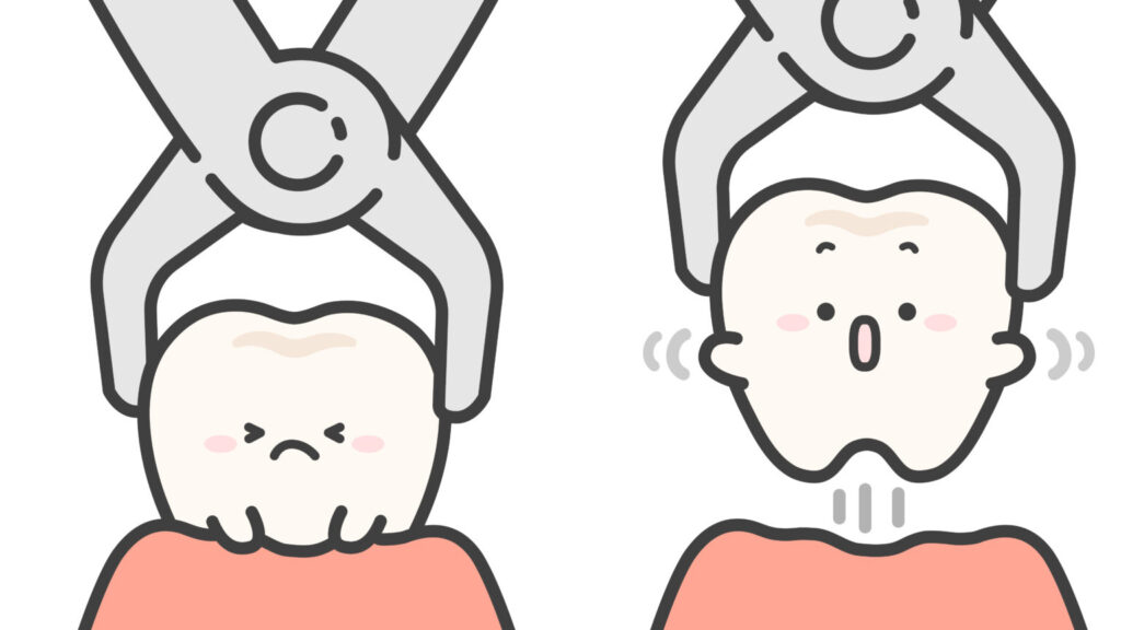 非抜歯矯正と抜歯矯正