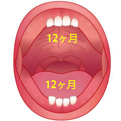 乳側切歯(B)