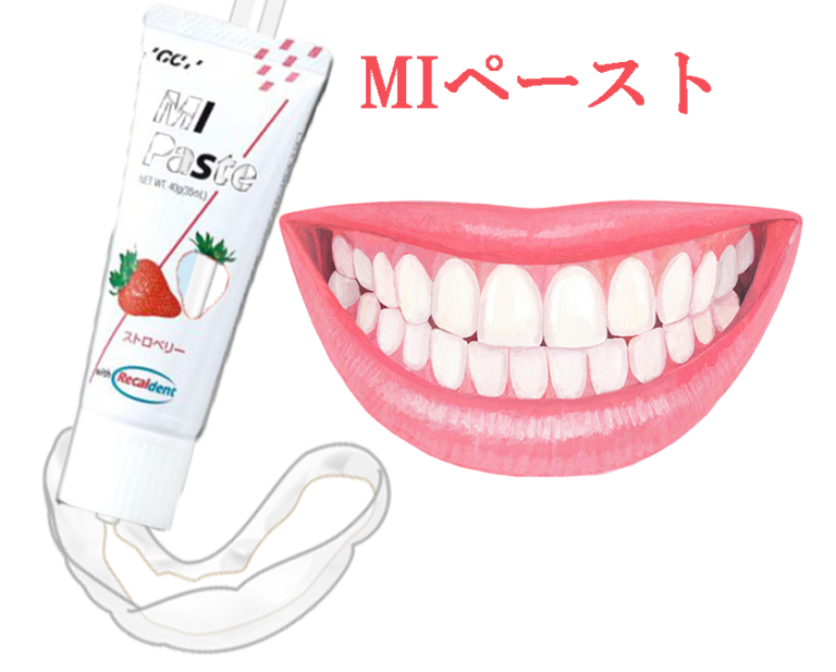 MIペースト