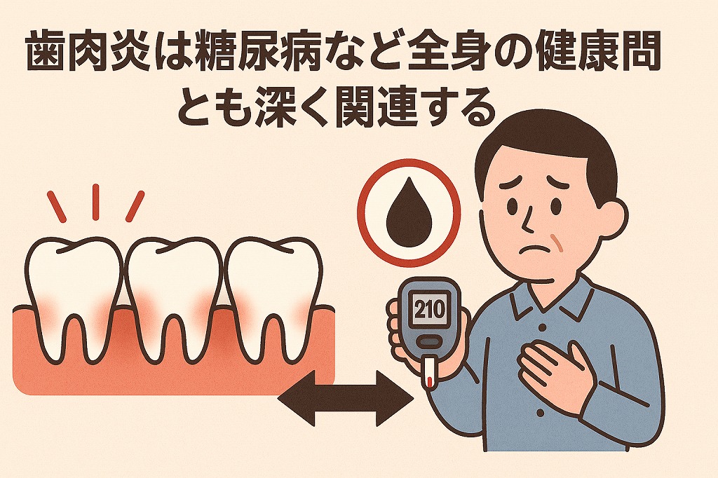 歯肉炎の関係性(糖尿病・心疾患)