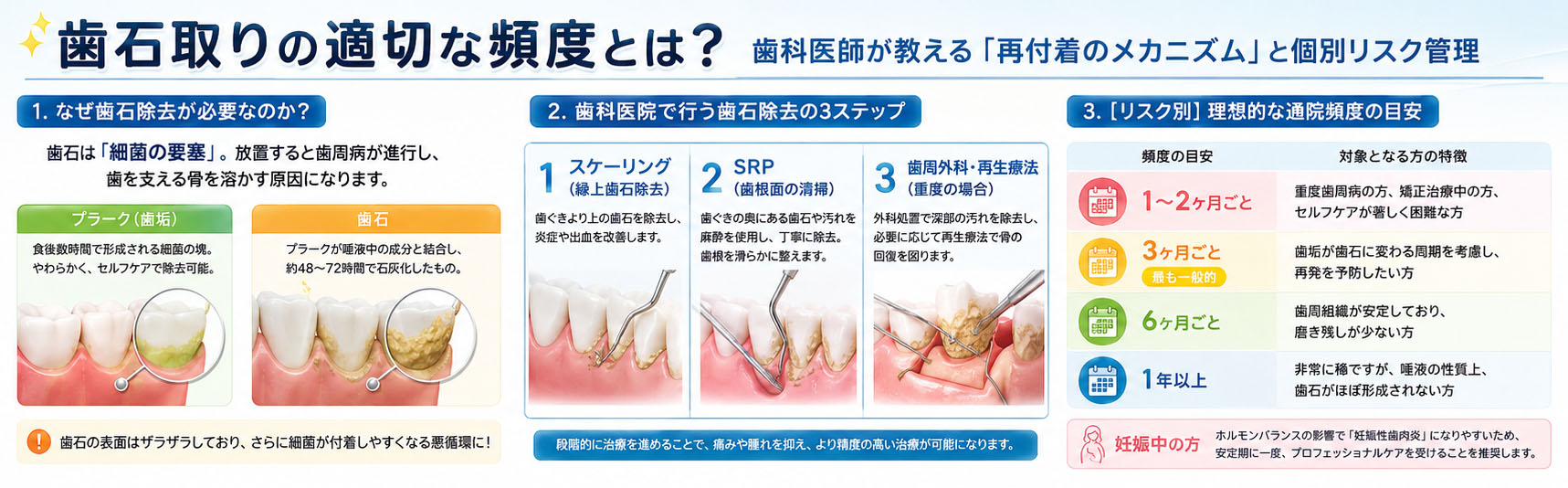 歯石取りの適切な頻度とは？