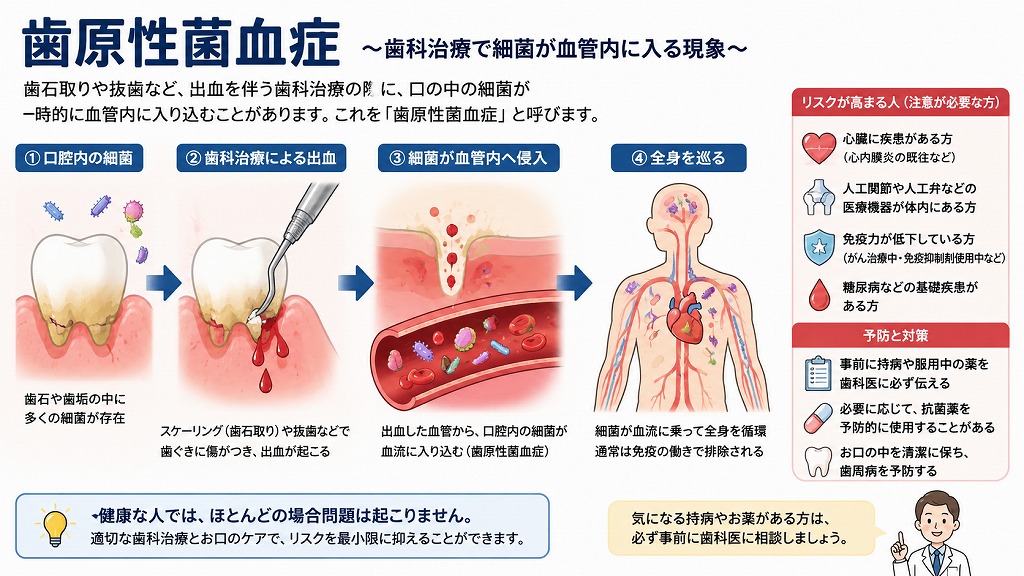 歯石取りで起こる「歯原性菌血症」とは？