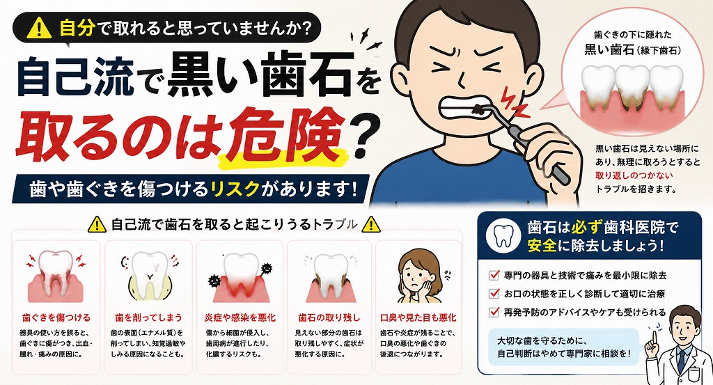 自己流で黒い歯石を取るのは危険？