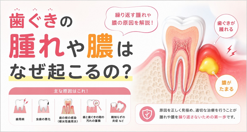 歯ぐきの腫れや膿はなぜ起こるの？