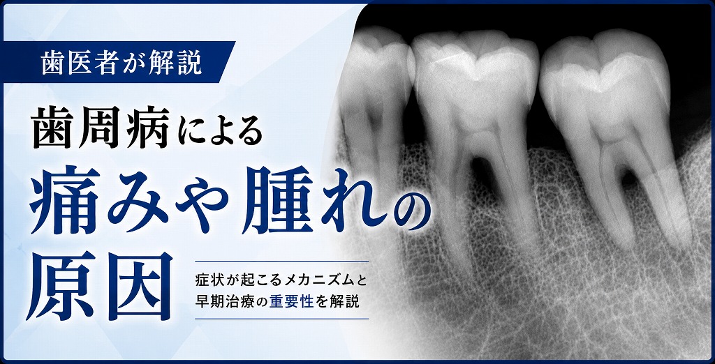 歯周病による痛みや腫れの原因