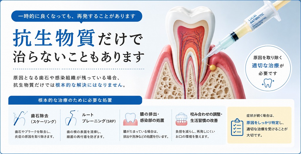 抗生物質だけで治らないこともあります