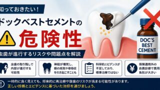 削らない虫歯治療」の落とし穴｜ドックベストセメントの危険性