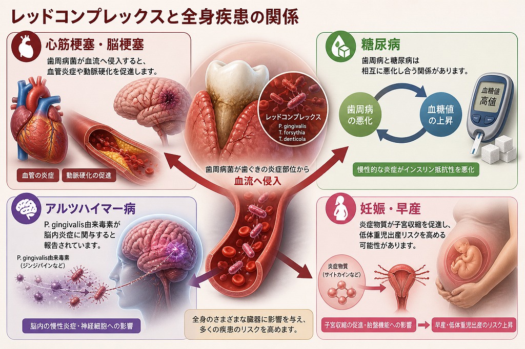 レッドコンプレックスと全身疾患の関係