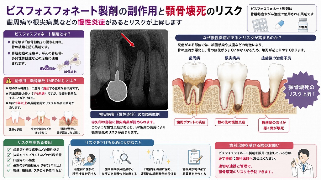 ビスフォスフォネート製剤の副作用と顎骨壊死のリスク