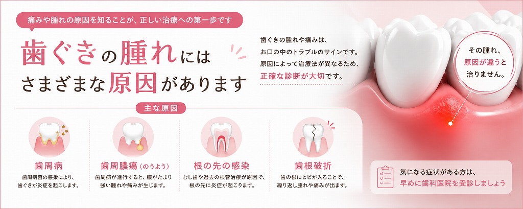 歯ぐきの腫れにはさまざまな原因があります