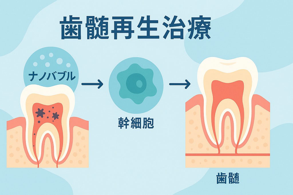 歯髄再生治療
