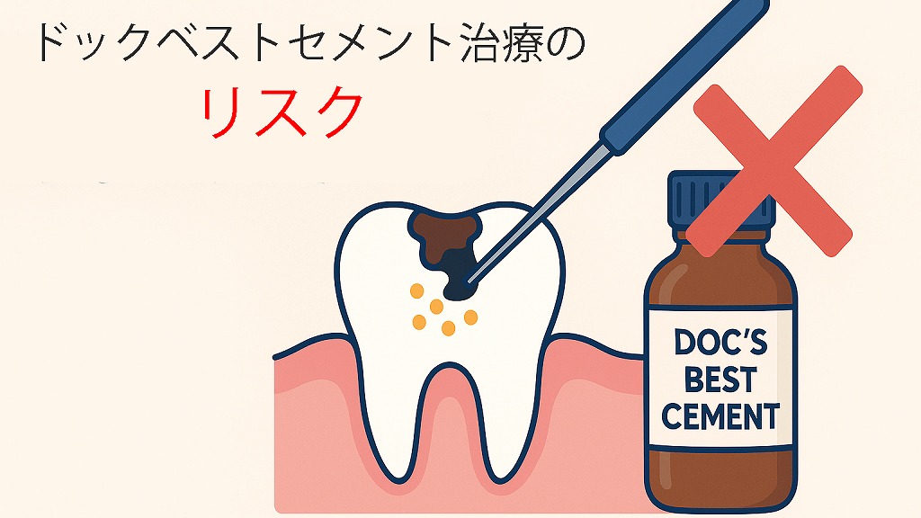 ドックベストセメント治療のリスク|知らないと危ない落とし穴