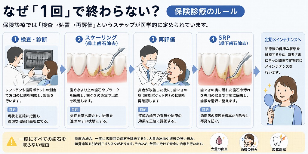 なぜ歯石取りは1回で終わらないの？
