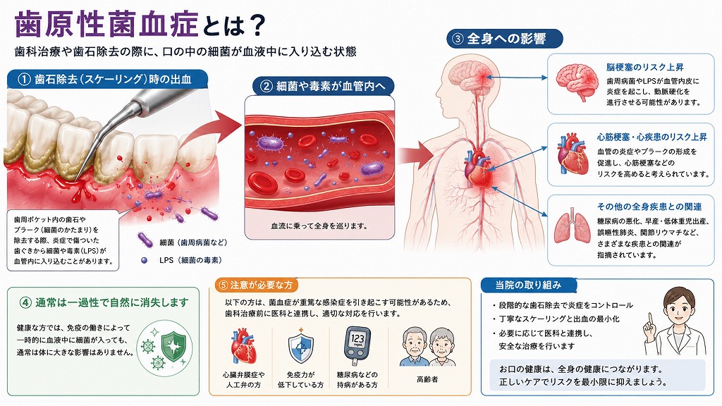 歯原性菌血症のリスク