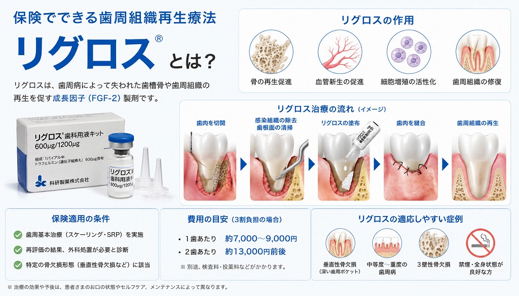 【裁断済み】　失敗しない歯周組織再生治療 失敗しない歯周組織再生治療／医歯薬出版株式会社