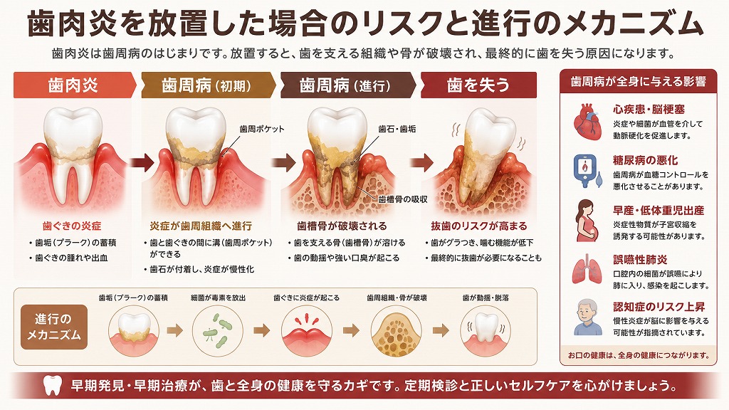 歯肉炎を放置するリスク