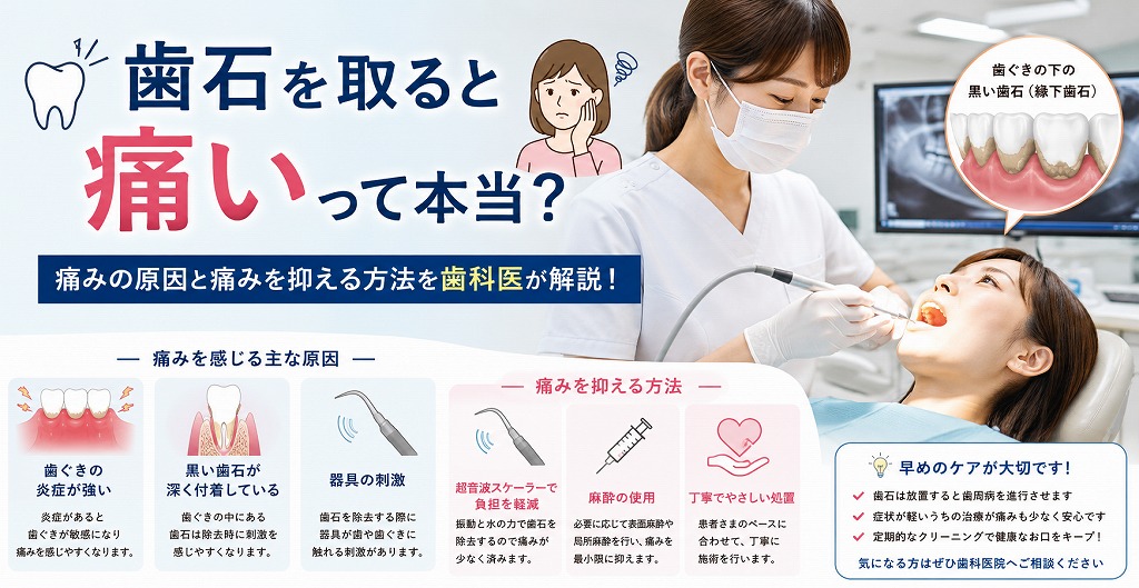江戸川区篠崎で黒い歯石を痛みなく除去したい方へ