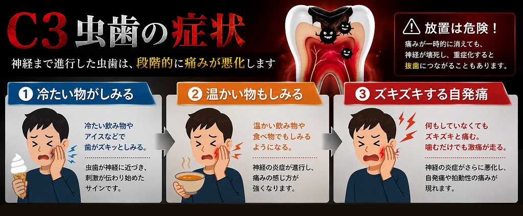 C3虫歯の症状（冷たいもの・温かいものに激痛）
