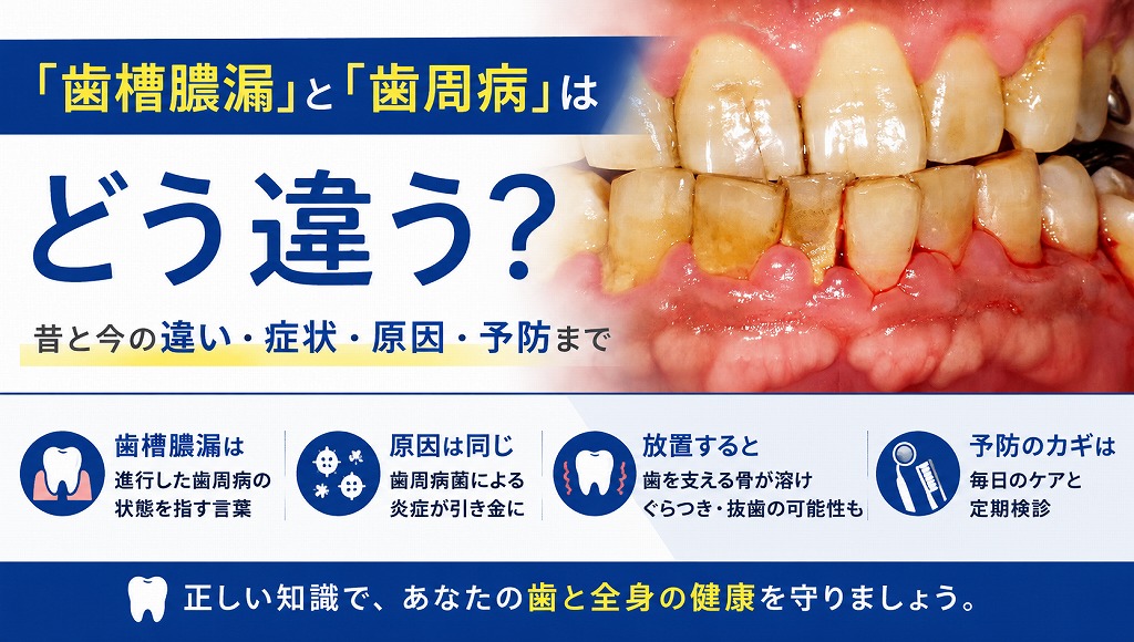 「歯槽膿漏」と「歯周病」はどう違う？